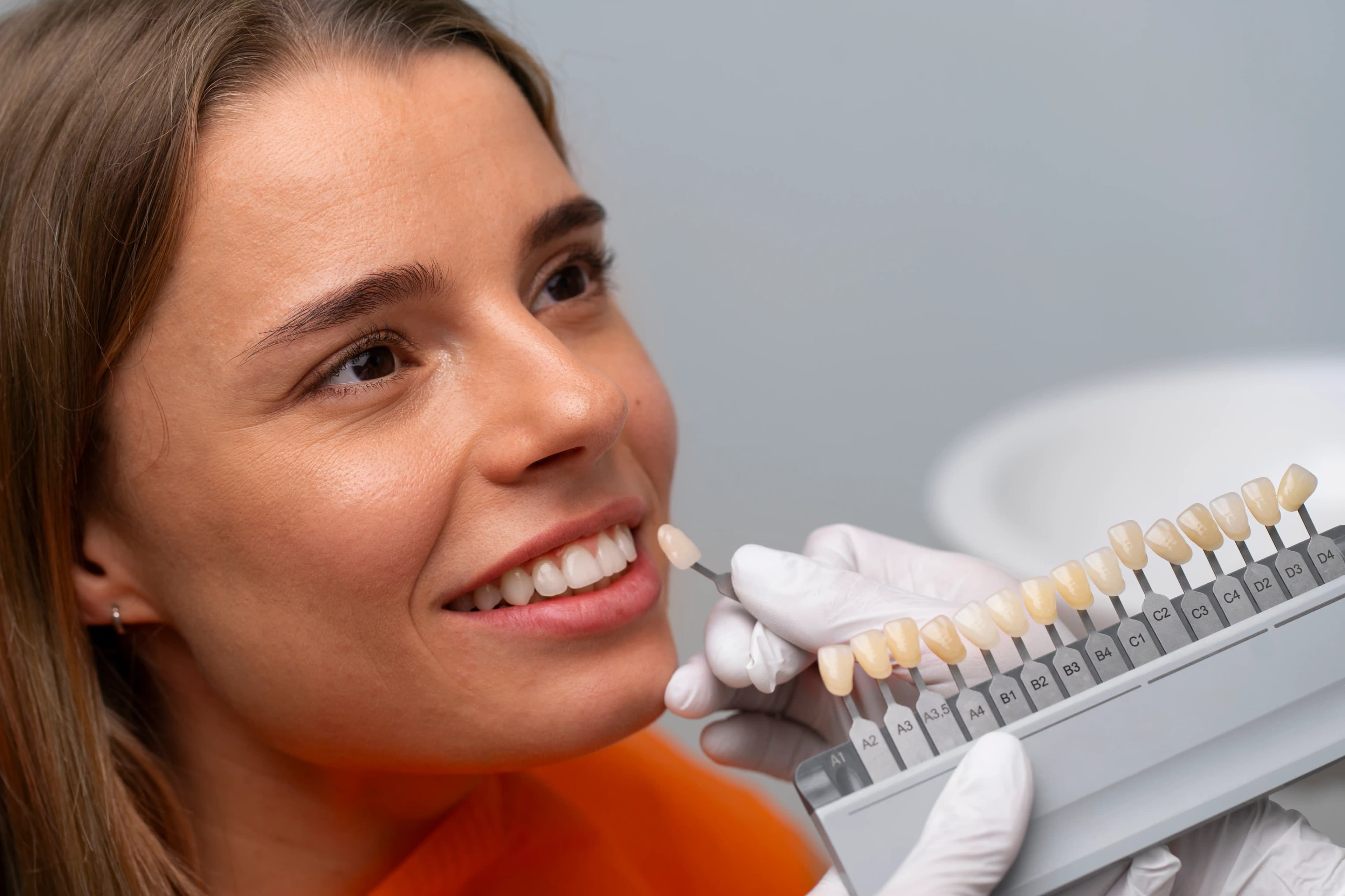 Dental Veneers